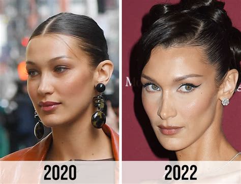 bella hadid buccal fat removal|17 Celebrities Who Have Had Buccal Fat Removal